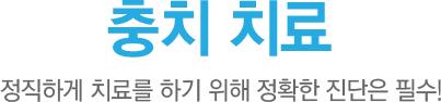 충치치료