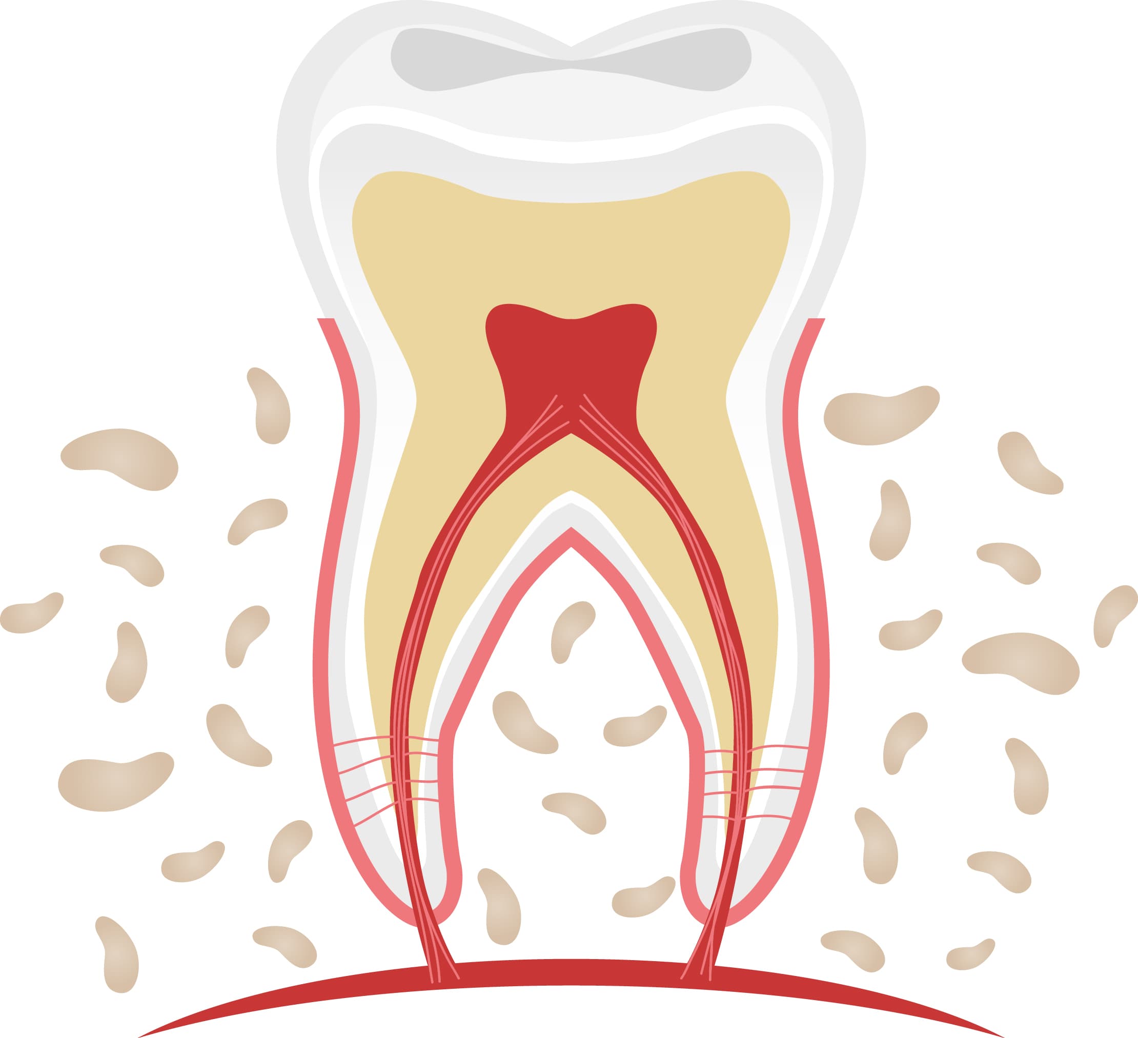 무삭제 라미네이트가 더 잘 붙는 이유 - 이미지 2