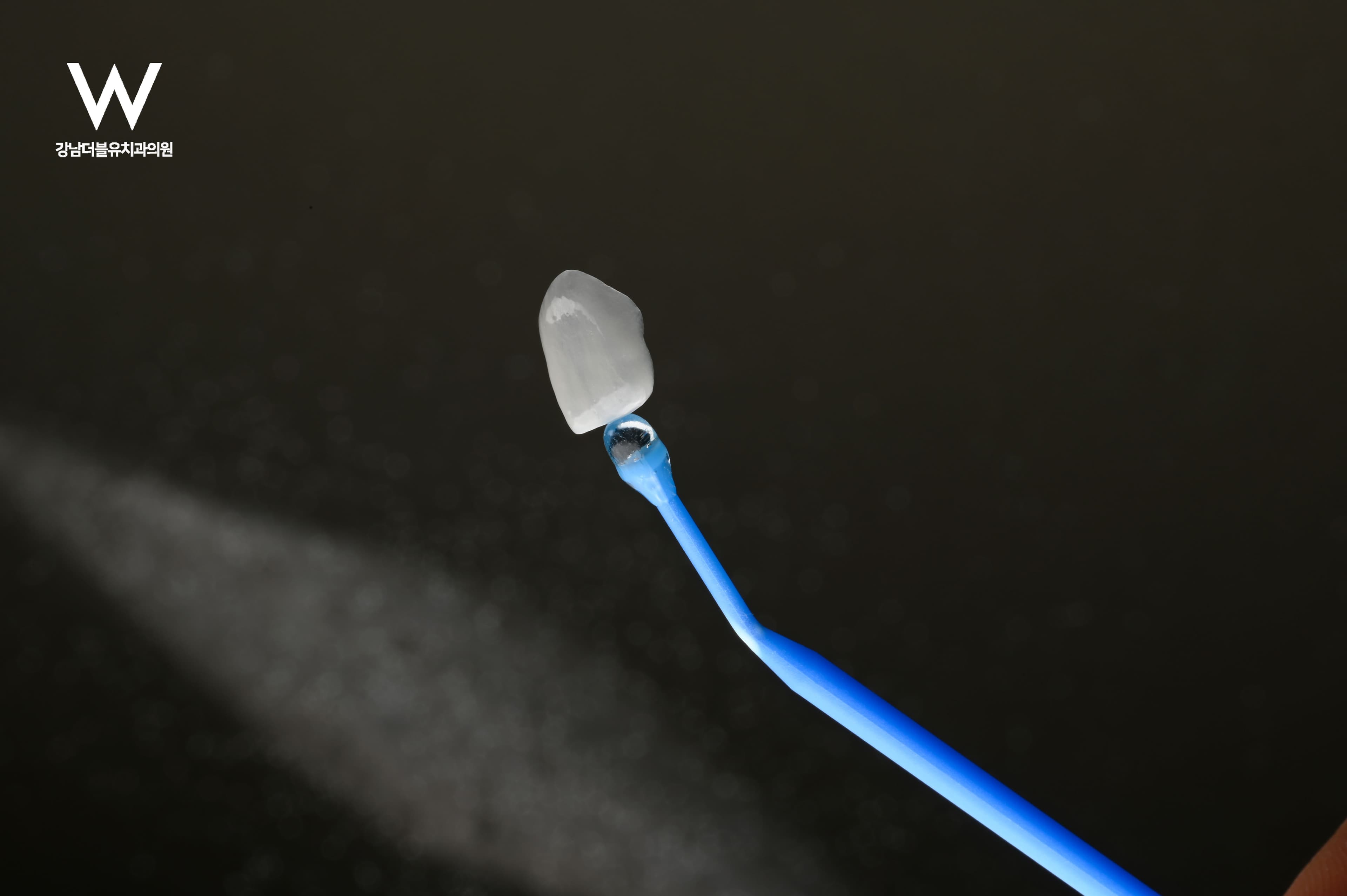 무삭제 라미네이트가 더 잘 붙는 이유 - 이미지 5