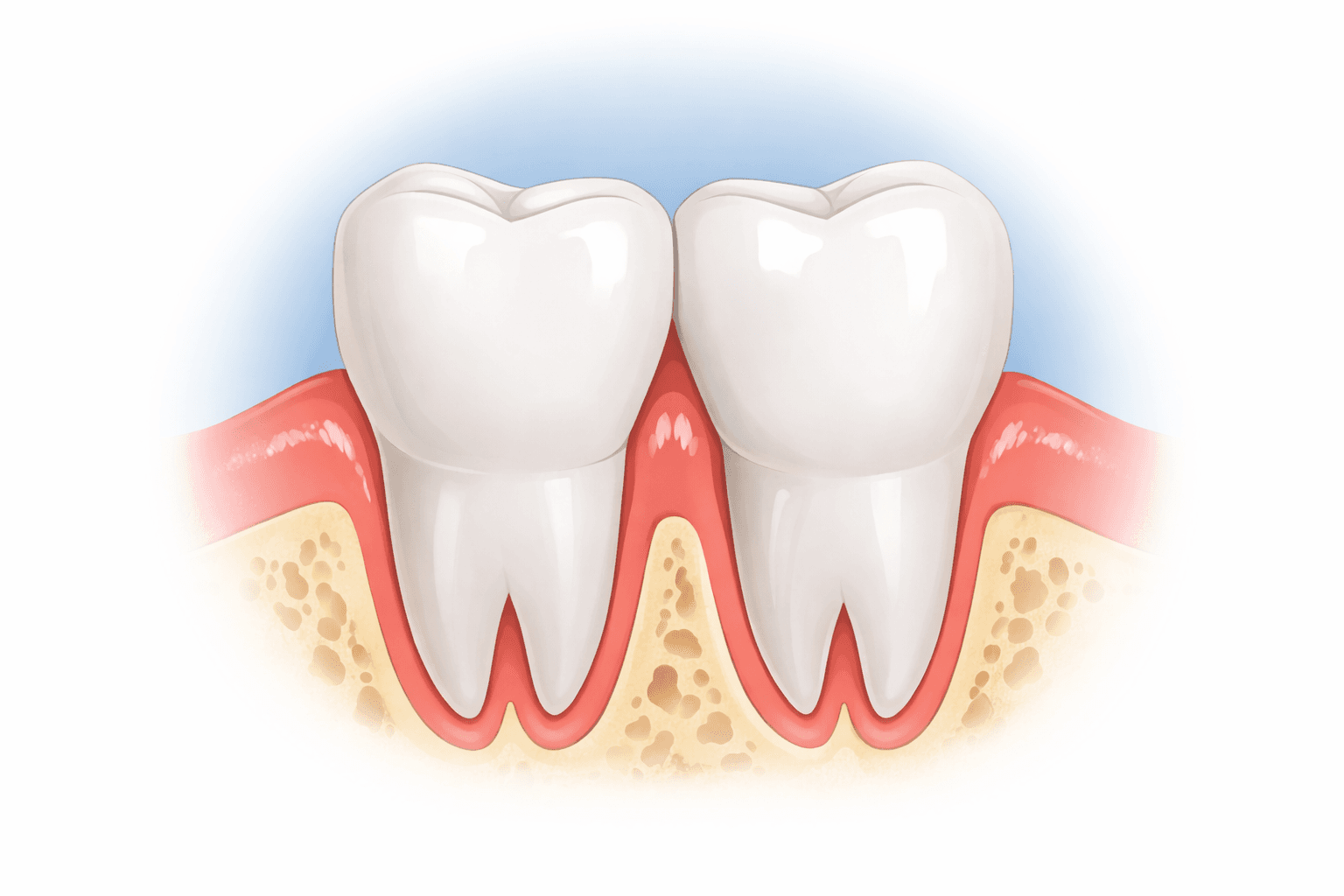 교정 후 블랙 트라이앵글, 잇몸 필러로 해결할 수 있을까? - 이미지 5