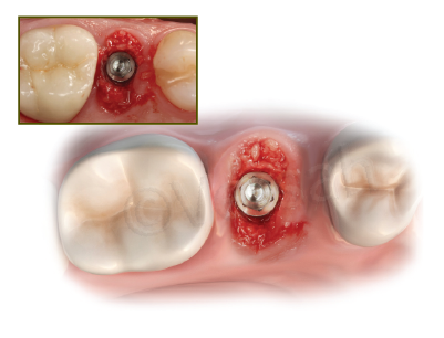 Case study 1