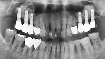 Case 2 After