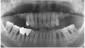 Case 2 Before