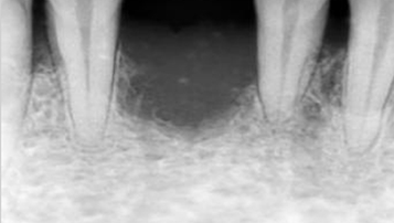 Case 4 Before