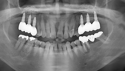 Case 2 After