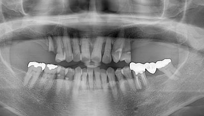 Case 2 Before