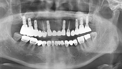 Case 4 After