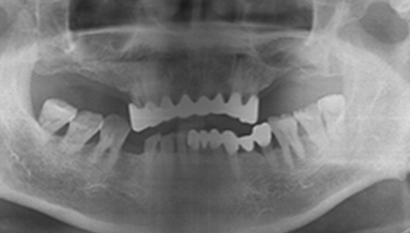 Case 4 Before