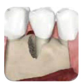 STEP 2: 스케일링 & 큐렛