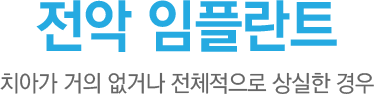 전악 임플란트
