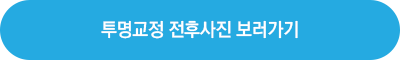 투명 교정 전후사진 보러가기